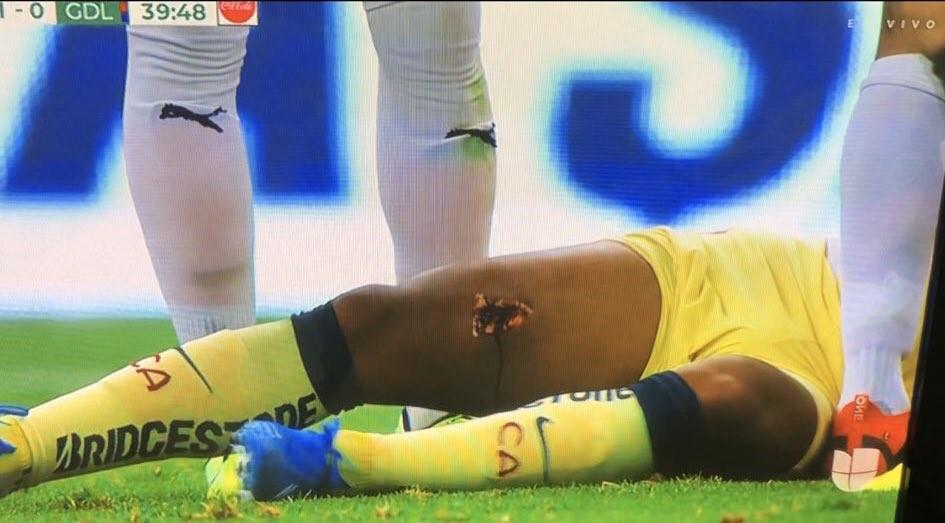Así fue la escalofriante entrada al ex barcelonista dos Santos que le hizo un agujero en la pierna
